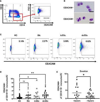 CEACAM 1, 3, 5 and 6 -positive classical monocytes correlate with interstitial lung disease in early systemic sclerosis